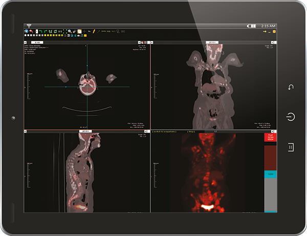 PET-CT-Viewer