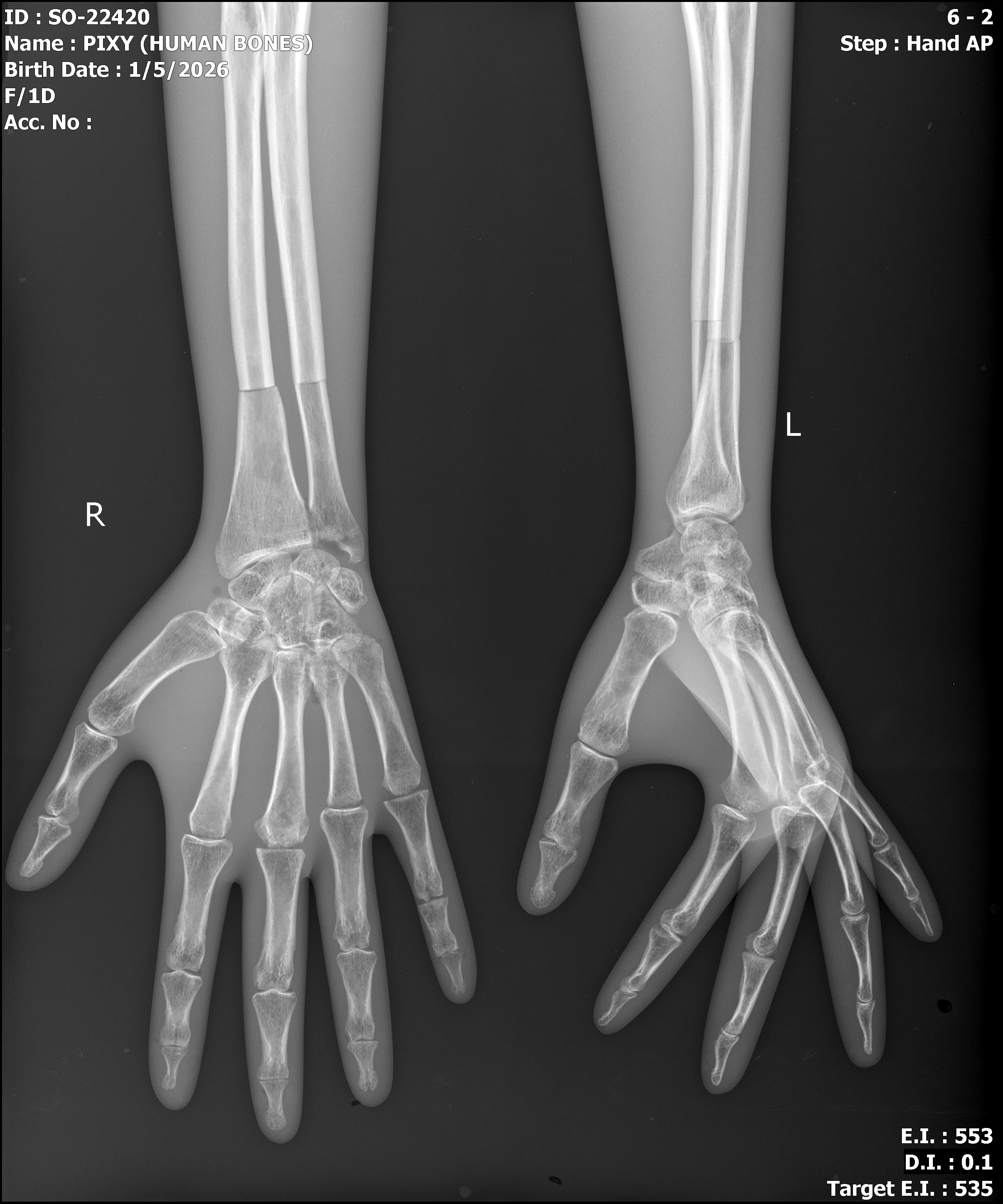 Take-Apart Pixy - Natural Bone